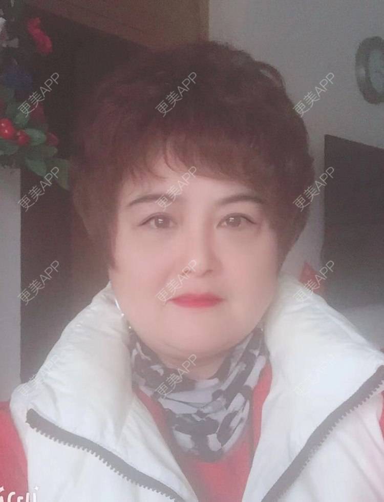 更美 - 更美用户K65AGrOxl2的内切去眼袋经验 | 内切去眼袋 | 成都