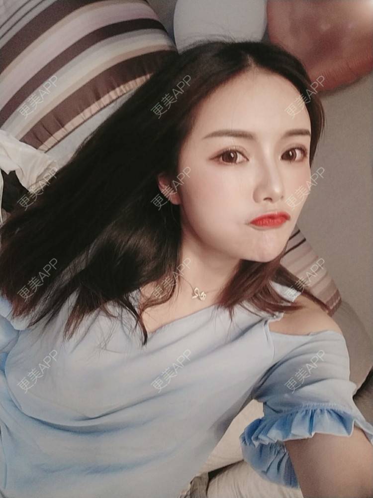 更美 - Daisy11的自体脂肪全面部填充经验 | 自体脂肪全面部填充 | 视频日记 | 重庆