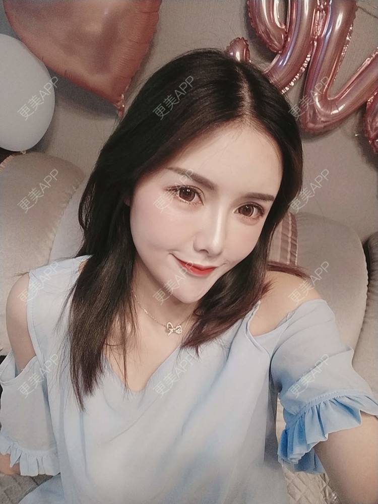 更美 - Daisy11的自体脂肪全面部填充经验 | 自体脂肪全面部填充 | 视频日记 | 重庆