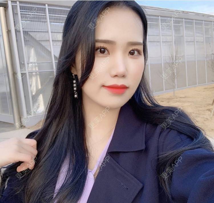 更美 - 一朵花🧚‍♀️的激光脱腋毛经验 | 激光脱腋毛 | 北京