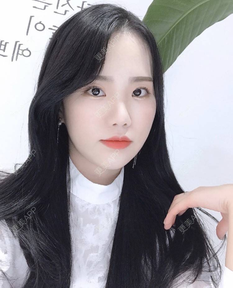 更美 - 一朵花🧚‍♀️的激光脱腋毛经验 | 激光脱腋毛 | 北京