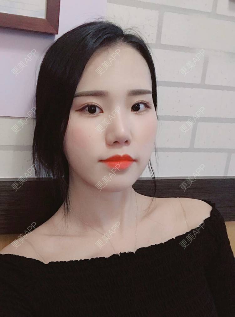 更美 - 一朵花🧚‍♀️的激光脱腋毛经验 | 激光脱腋毛 | 北京