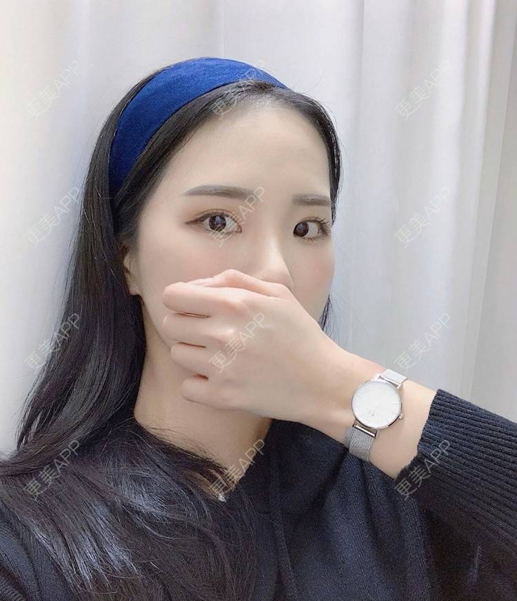 更美 - 一朵花🧚‍♀️的激光脱腋毛经验 | 激光脱腋毛 | 北京