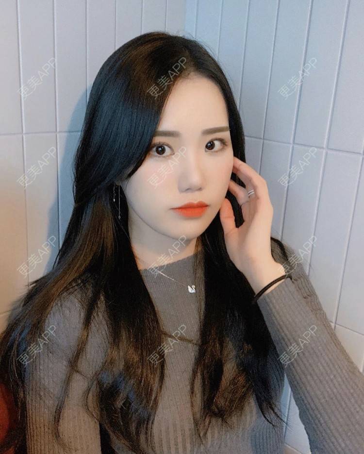 更美 - 一朵花🧚‍♀️的激光脱腋毛经验 | 激光脱腋毛 | 北京