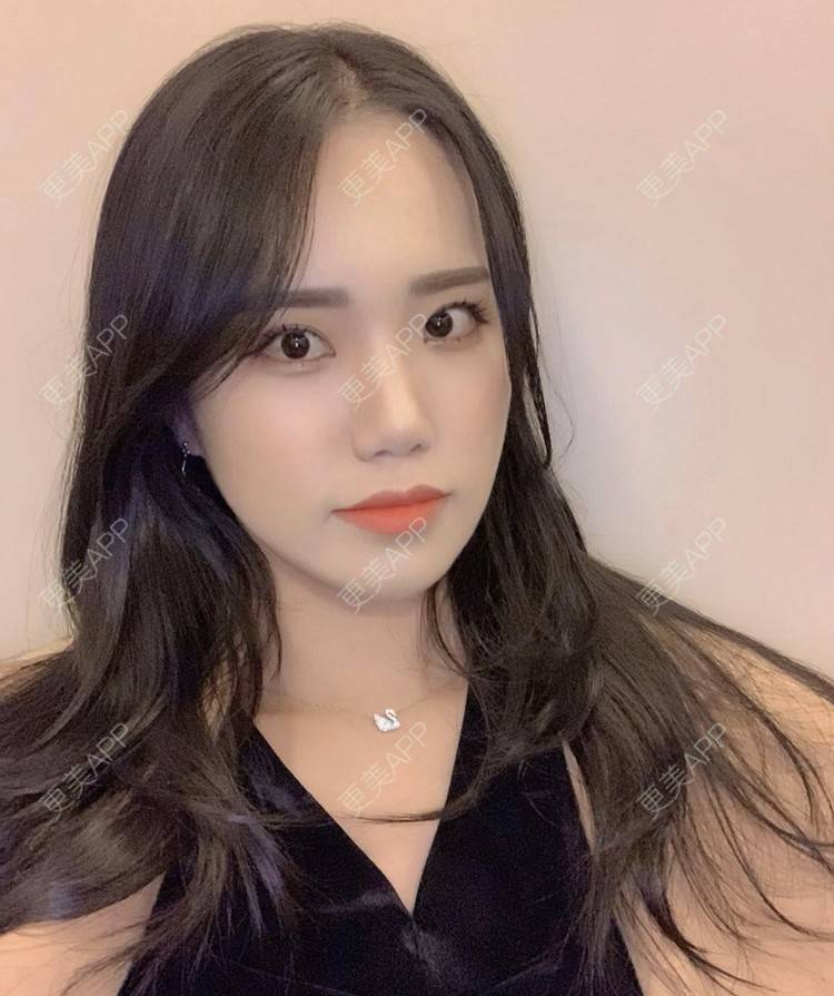 更美 - 一朵花🧚‍♀️的激光脱腋毛经验 | 激光脱腋毛 | 北京