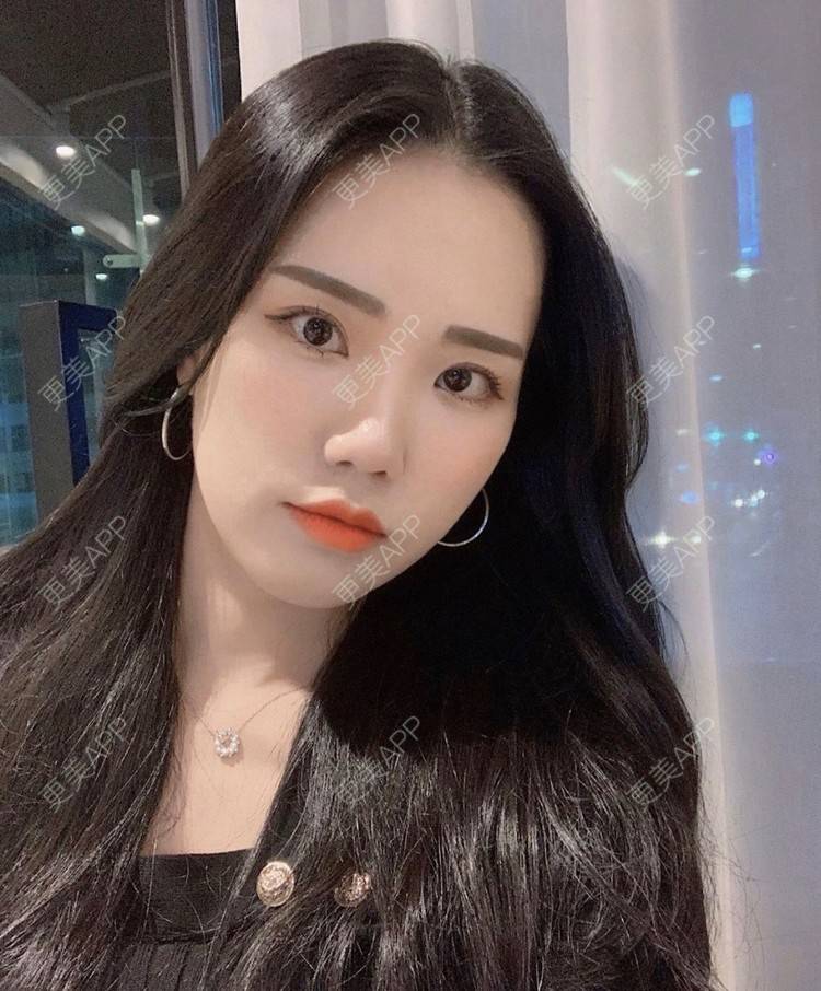 更美 - 一朵花🧚‍♀️的激光脱腋毛经验 | 激光脱腋毛 | 北京