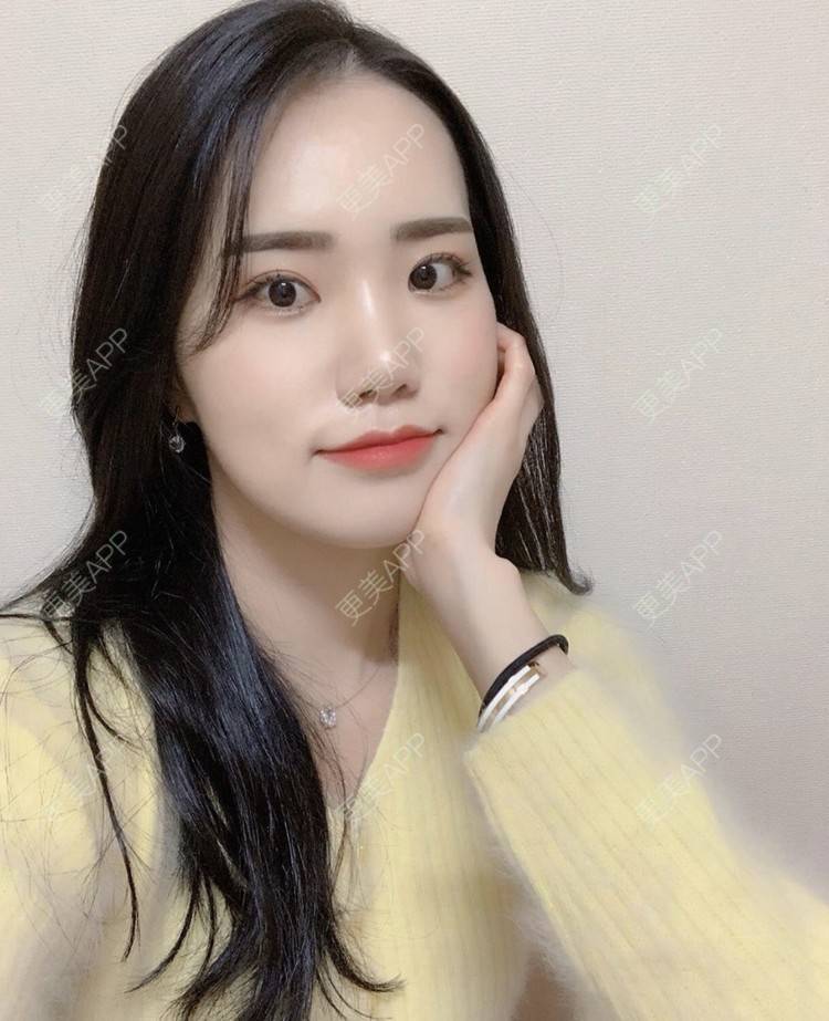 更美 - 一朵花🧚‍♀️的激光脱腋毛经验 | 激光脱腋毛 | 北京