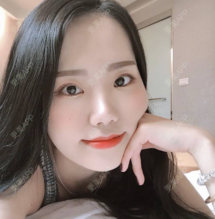 更美 - 一朵花🧚‍♀️的激光脱腋毛经验 | 激光脱腋毛 | 北京