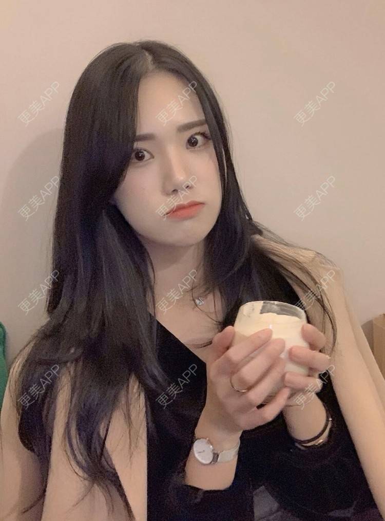 更美 - 一朵花🧚‍♀️的激光脱腋毛经验 | 激光脱腋毛 | 北京