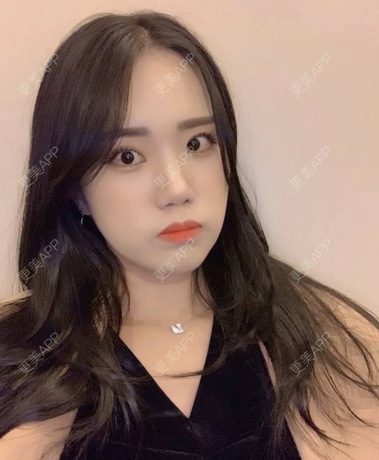 更美 - 一朵花🧚‍♀️的激光脱腋毛经验 | 激光脱腋毛 | 北京