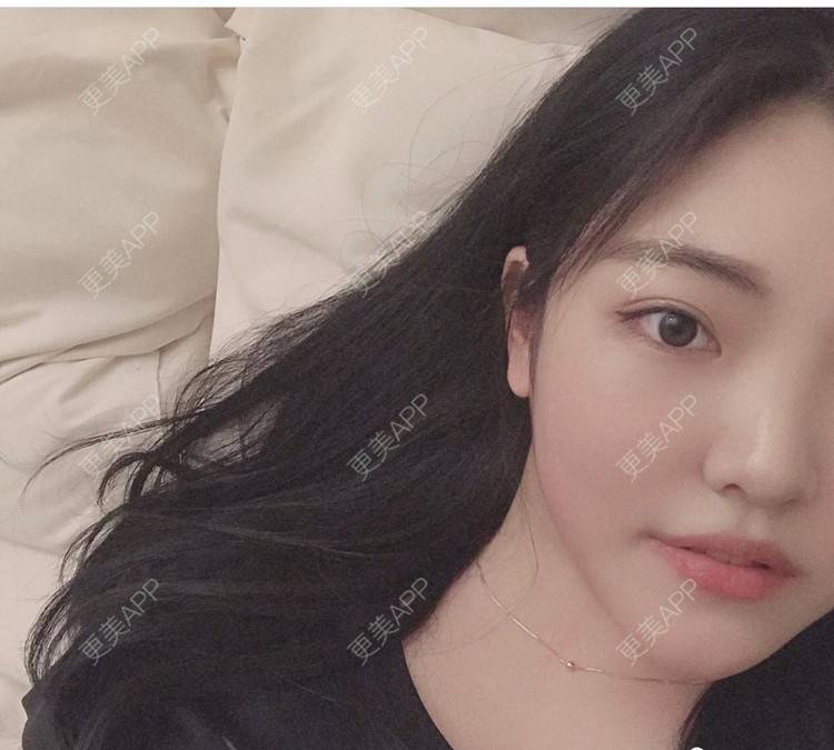 更美 - 一枚小可爱糖的大腿脱毛经验 | 大腿脱毛 | 北京