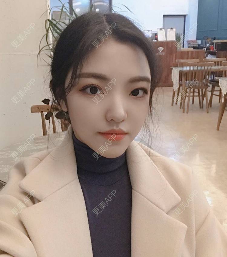 更美 - 一枚小可爱糖的大腿脱毛经验 | 大腿脱毛 | 北京