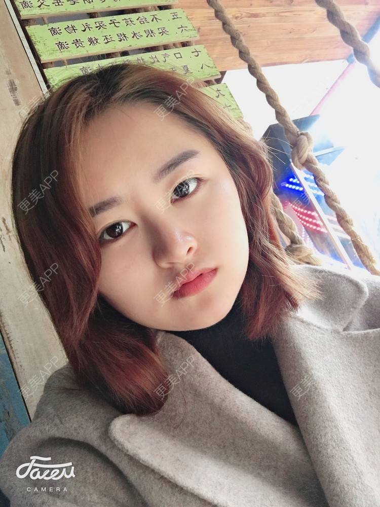 更美 - 浑身上下的肋软骨隆鼻经验 | 更美研究所 | 杭州 | 肋软骨隆鼻 | 隆鼻