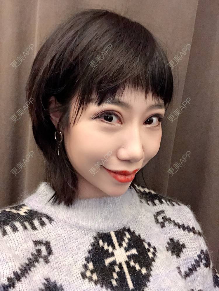 更美 - 🍬肉肉肉肉丝的下巴经验 | 下巴 | 硅胶垫下巴 | 哈尔滨