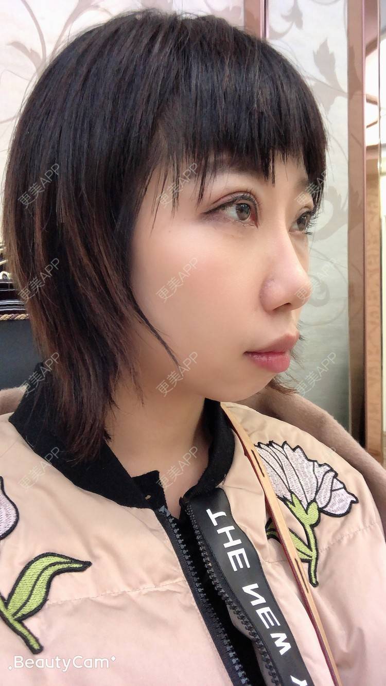 更美 - 🍬肉肉肉肉丝的下巴经验 | 下巴 | 硅胶垫下巴 | 哈尔滨