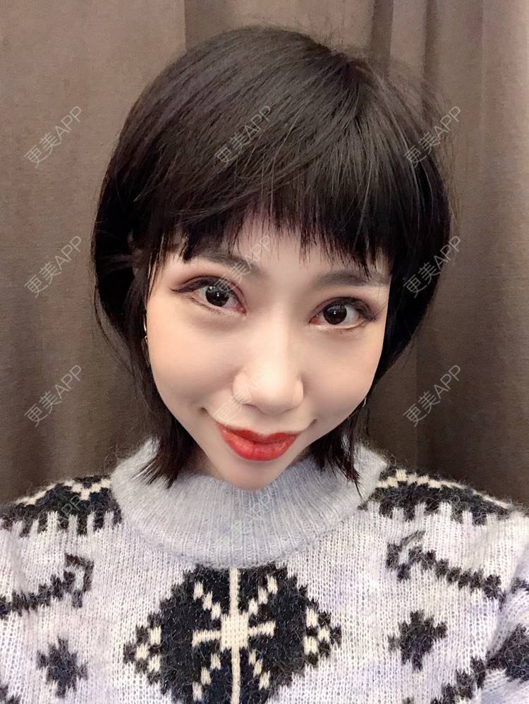 更美 - 🍬肉肉肉肉丝的下巴经验 | 下巴 | 硅胶垫下巴 | 哈尔滨