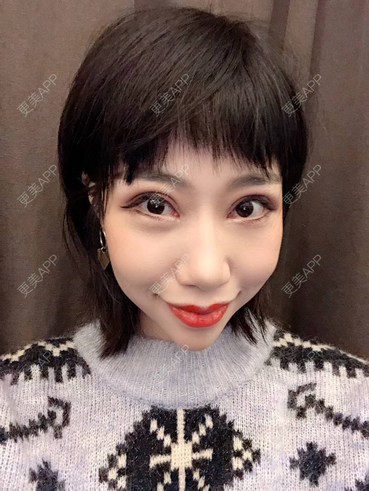 更美 - 🍬肉肉肉肉丝的下巴经验 | 下巴 | 硅胶垫下巴 | 哈尔滨