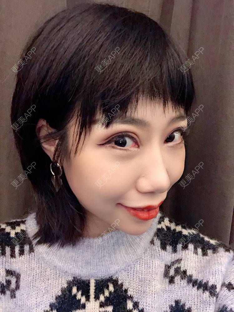 更美 - 🍬肉肉肉肉丝的下巴经验 | 下巴 | 硅胶垫下巴 | 哈尔滨