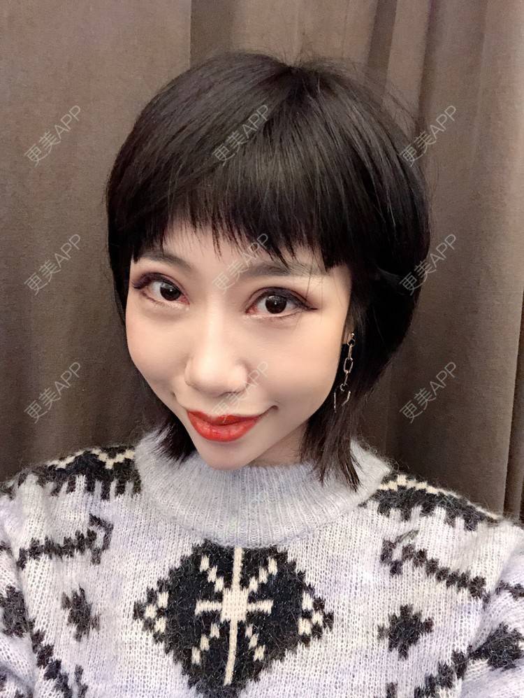 更美 - 🍬肉肉肉肉丝的下巴经验 | 下巴 | 硅胶垫下巴 | 哈尔滨