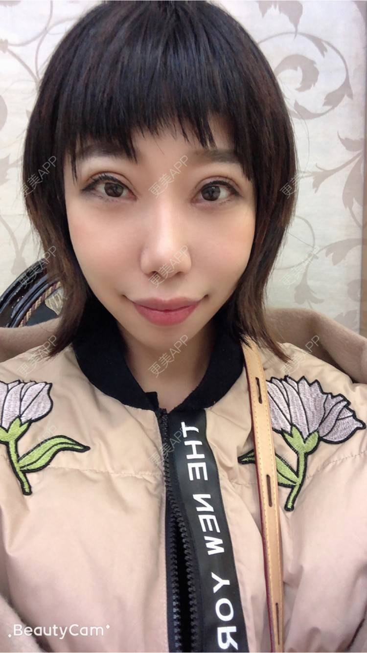 更美 - 🍬肉肉肉肉丝的下巴经验 | 下巴 | 哈尔滨