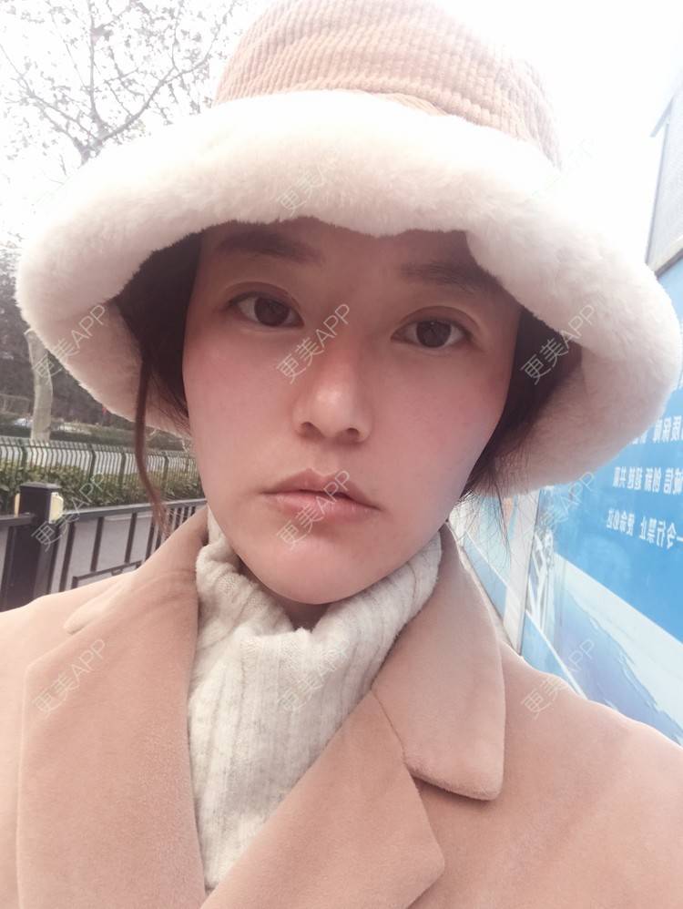 更美 - 更美用户Deo4FYoVXj的清洁水光补水经验 | 杭州 | 清洁水光补水
