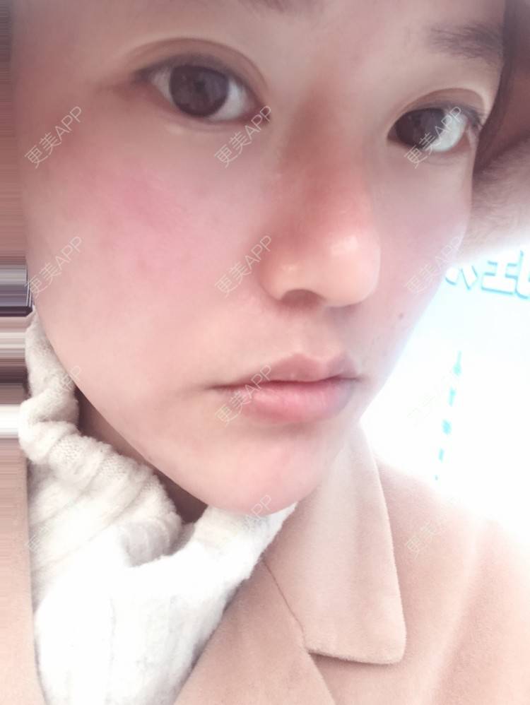 更美 - 更美用户Deo4FYoVXj的清洁水光补水经验 | 杭州 | 清洁水光补水