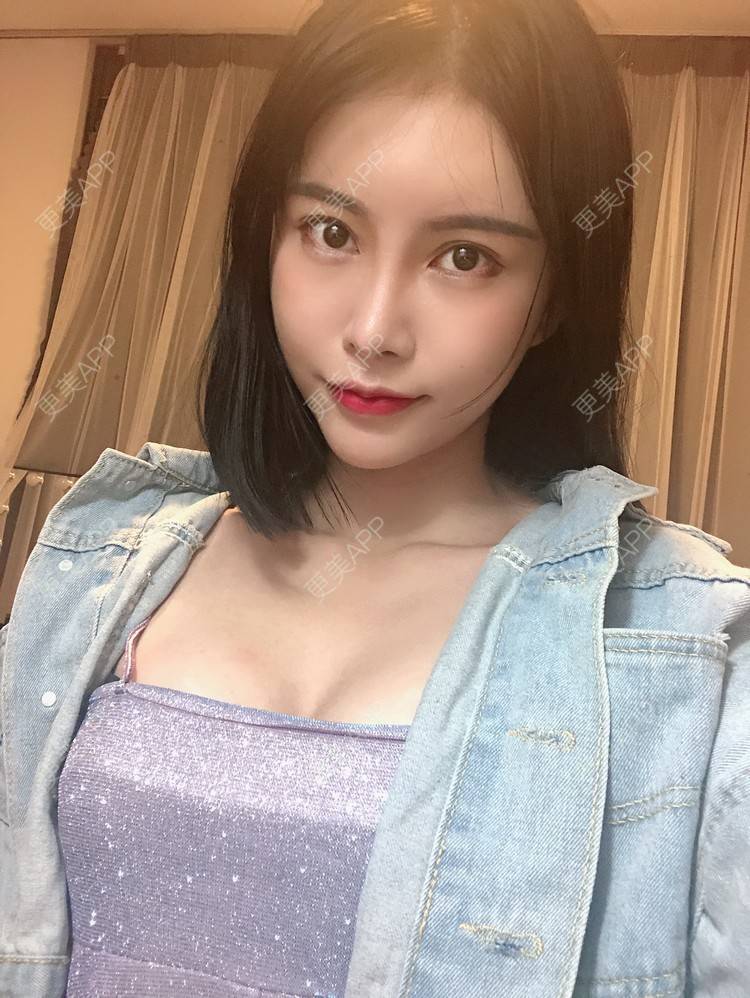 月亮警察的假体隆胸日记