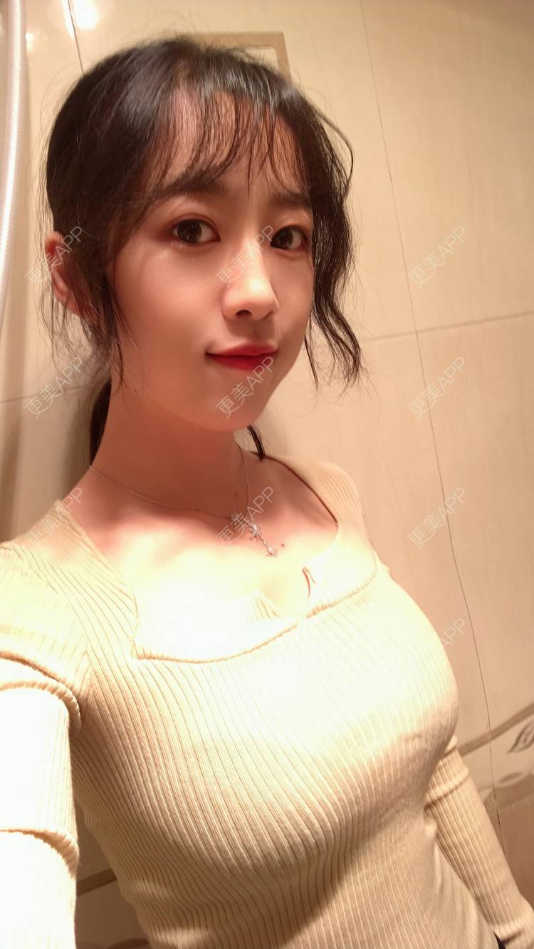 假体隆胸效果图_peacte假体隆胸效果图_术后46天__更美