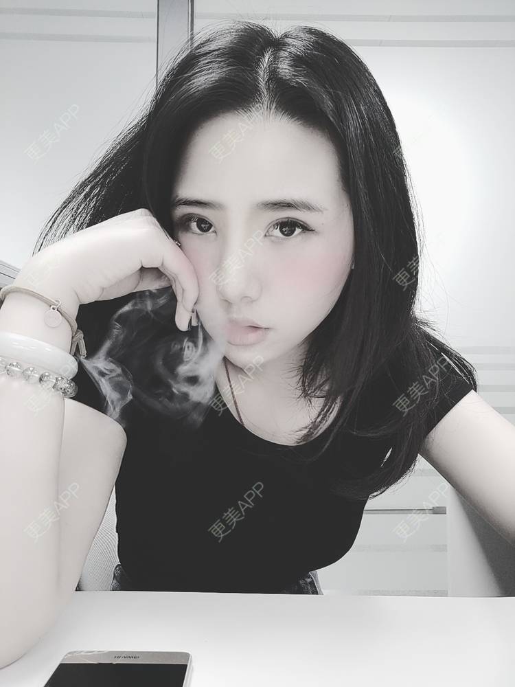 更美 - 更美用户R2vuT1w108的双眼皮修复经验 | 广州 | 双眼皮修复