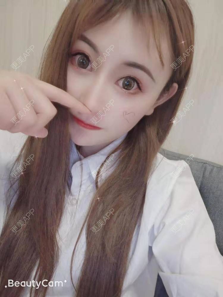 更美 - 更美用户U6Pt7ApV7A的吸脂瘦脸经验 | 吸脂瘦脸 | 重庆