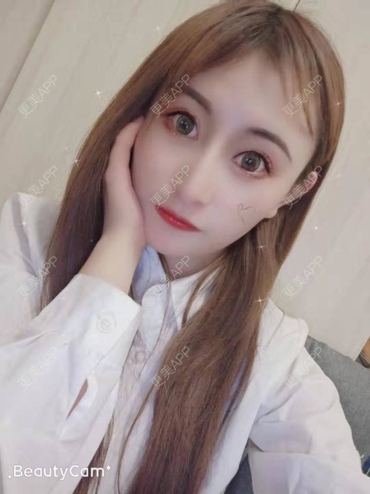 更美 - 更美用户U6Pt7ApV7A的吸脂瘦脸经验 | 吸脂瘦脸 | 重庆