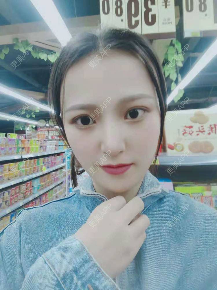 更美 - 勤晴小姐🌿的肋软骨隆鼻经验 | 肋软骨隆鼻 | 隆鼻 | 南京