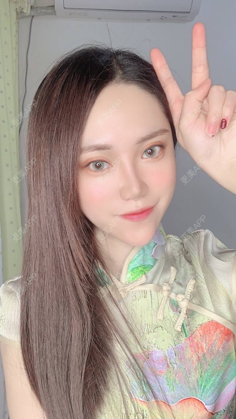 更美 - 小Kimi哟~倭的激光淡化妊娠纹经验 | 成都 | 妊娠纹 | 激光淡化妊娠纹