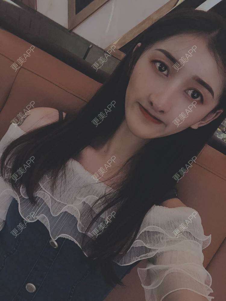 更美 - 最美的期待i的鼻形态修复经验 | 广州 | 鼻形态修复