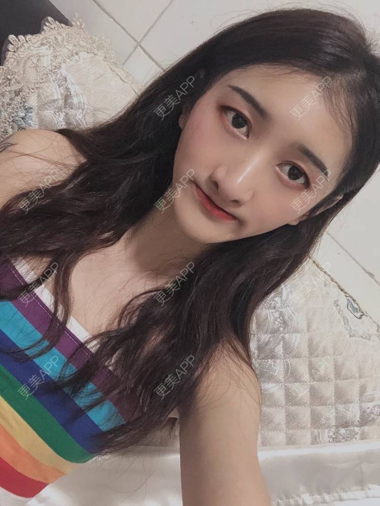 更美 - 最美的期待i的鼻形态修复经验 | 广州 | 鼻形态修复