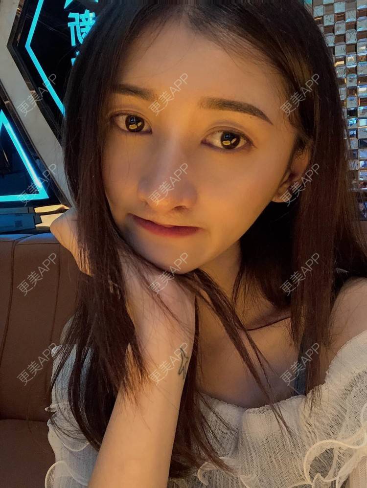 更美 - 最美的期待i的鼻形态修复经验 | 广州 | 鼻形态修复