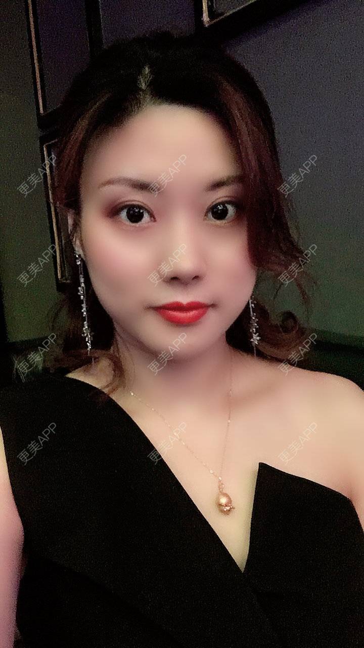更美 - 更美用户Fbey21Pntj的祛斑祛色素经验 | 祛斑祛色素 | 皮秒激光 | 改善肤质 | 广州 | 激光淡疤 | 激光淡斑