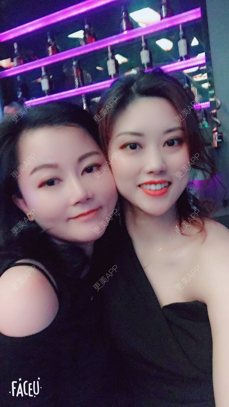 更美 - 更美用户Fbey21Pntj的祛斑祛色素经验 | 祛斑祛色素 | 皮秒激光 | 改善肤质 | 广州 | 激光淡疤 | 激光淡斑