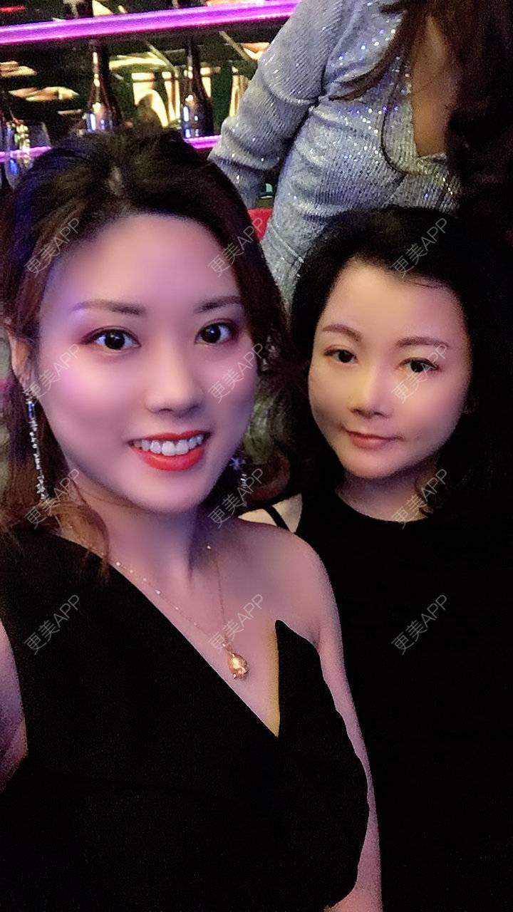 更美 - 更美用户Fbey21Pntj的祛斑祛色素经验 | 祛斑祛色素 | 皮秒激光 | 改善肤质 | 广州 | 激光淡疤 | 激光淡斑