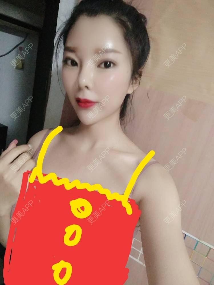 胸部下垂矫正 | 自体脂肪隆胸 | 重庆 | 胶原蛋白丰胸 | 玻尿酸仑胸