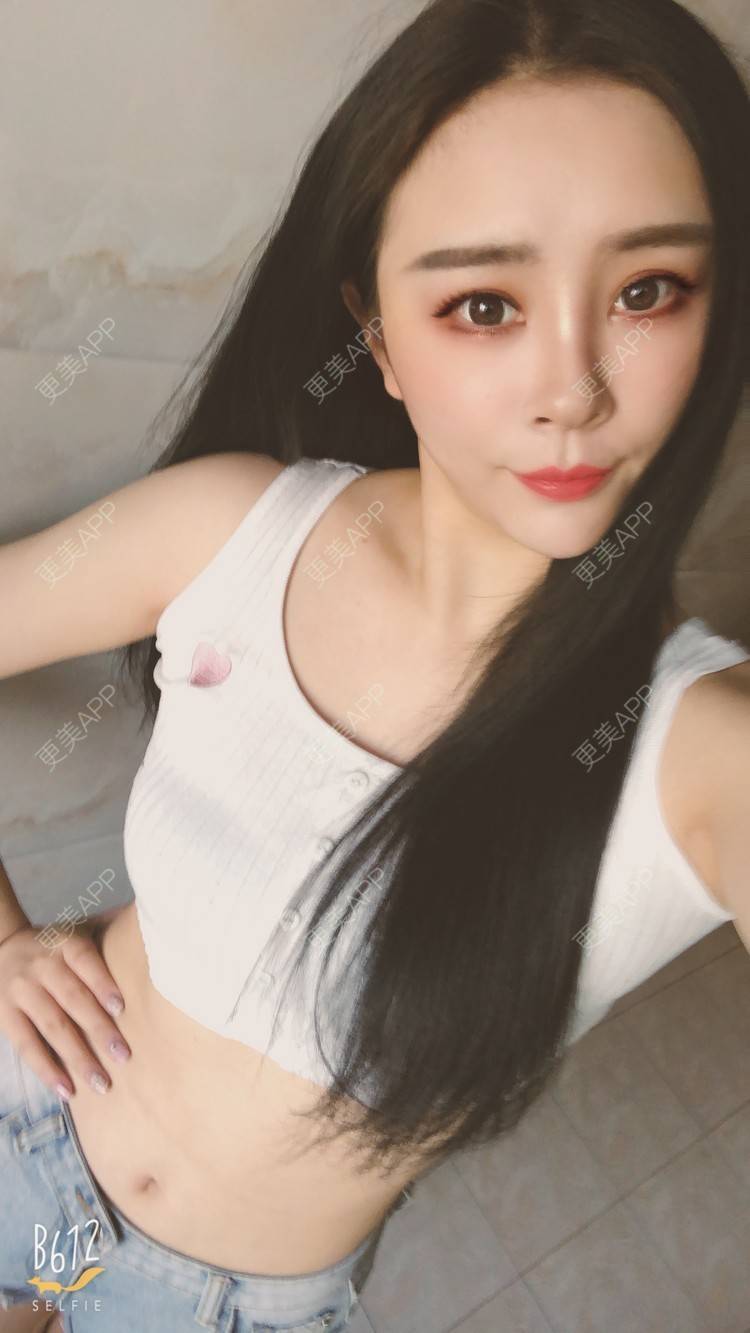 更美 - °薄凉的射频溶脂瘦手臂经验 | 杭州 | 视频日记 | 射频溶脂瘦手臂