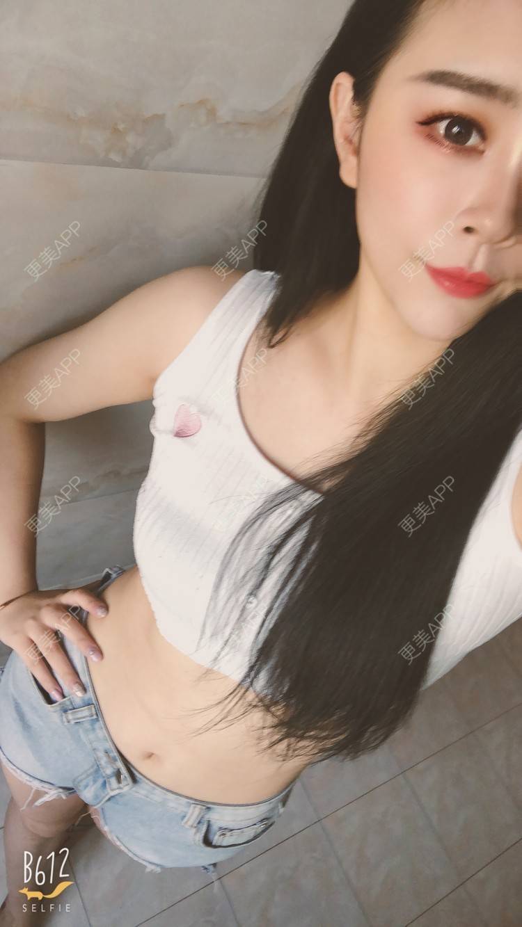 更美 - °薄凉的射频溶脂瘦手臂经验 | 杭州 | 视频日记 | 射频溶脂瘦手臂
