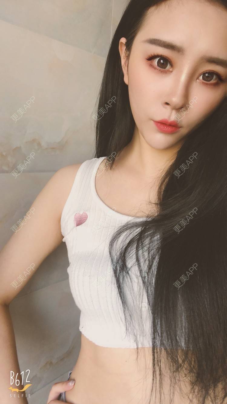 更美 - °薄凉的射频溶脂瘦手臂经验 | 杭州 | 视频日记 | 射频溶脂瘦手臂