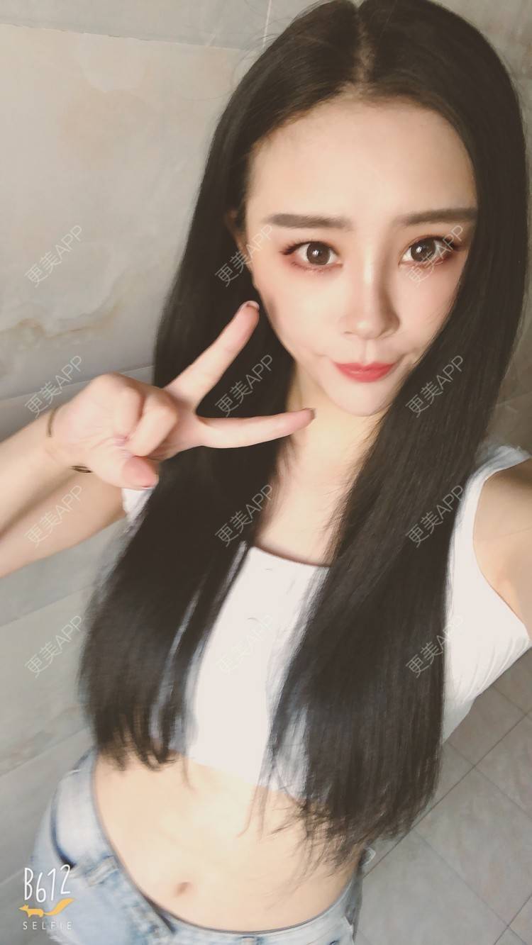 更美 - °薄凉的射频溶脂瘦手臂经验 | 杭州 | 视频日记 | 射频溶脂瘦手臂