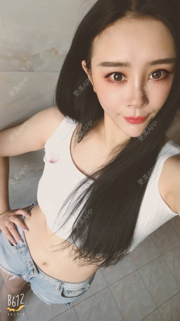 更美 - °薄凉的射频溶脂瘦手臂经验 | 杭州 | 视频日记 | 射频溶脂瘦手臂
