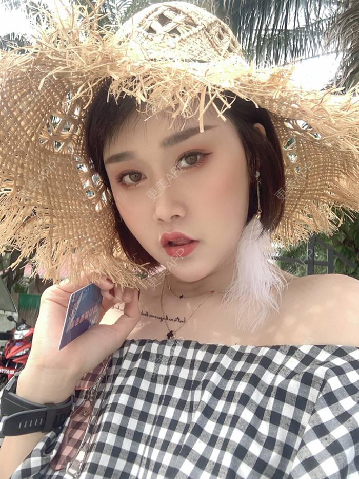 更美 - 画个橘子给你吃的鼻部多项经验 | 鼻部多项 | 膨体隆鼻 | 肋软骨隆鼻 | 重庆 | 鼻中隔软骨隆鼻 | 耳软骨隆鼻