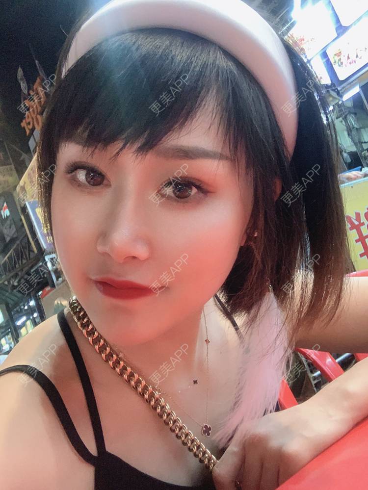 更美 - 画个橘子给你吃的鼻部多项经验 | 鼻部多项 | 膨体隆鼻 | 肋软骨隆鼻 | 重庆 | 鼻中隔软骨隆鼻 | 耳软骨隆鼻