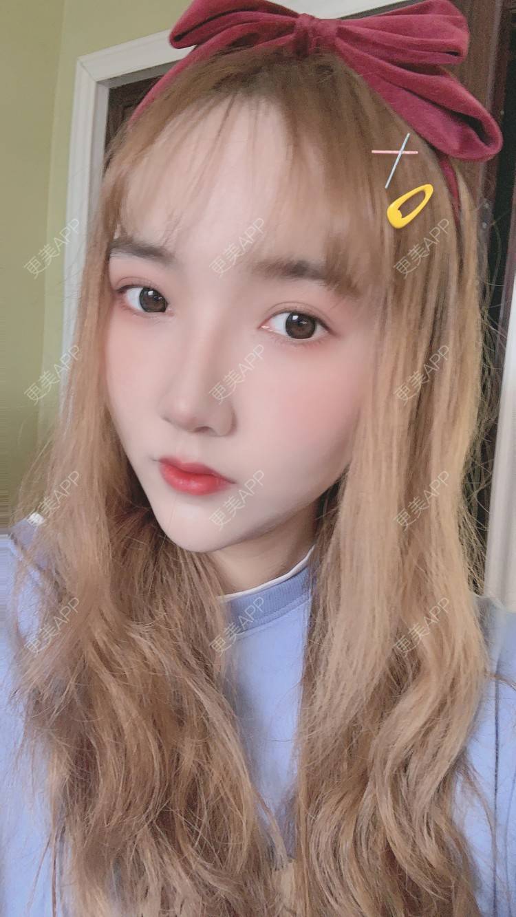 更美 - 林林兮兮的硅胶垫下巴经验 | 硅胶垫下巴 | 武汉