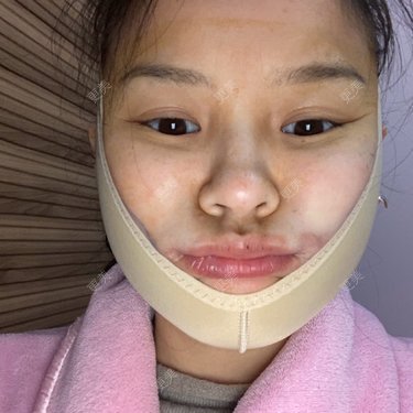 一白遮三丑丑丑