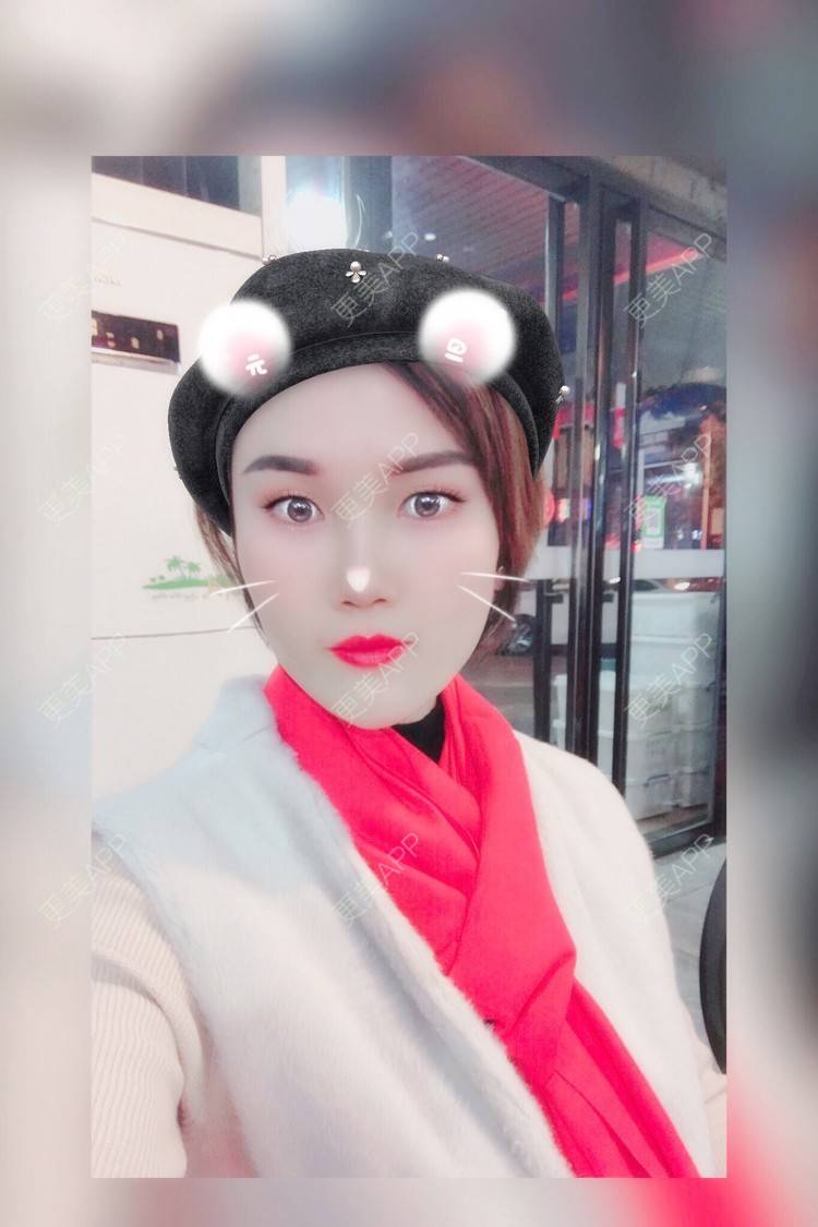 更美 - 安迪🌷的玻尿酸面颊经验 | 视频日记 | 上海 | 玻尿酸面颊